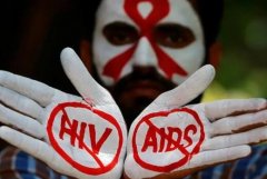 Fifteen Minutes to Ease HIV/AIDS-Related Anxiety: A Practical Approach